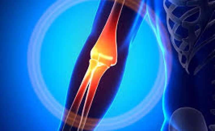 Επικονδυλίτιδα